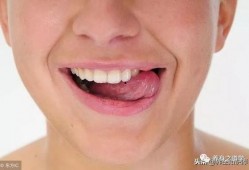 吃瓜吃的舌头疼缓解方法,吃瓜过度舌头疼的缓解攻略